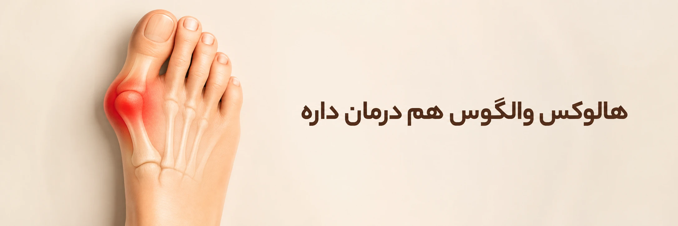 هالوکس والگوس